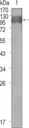 FLT1 Primary Antibody  MP20387 [M3D10]