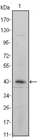 ITGA5 Primary Antibody MP20411 [M10F6]