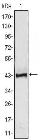 ATP2C1 Primary Antibody MP30001  [M4G12]