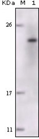 FES Primary Antibody MP20148 [M5A11G5]