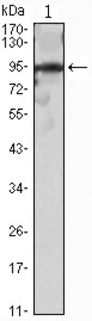 SNAI2 Primary Antibody MP30037 [M2H5]