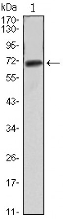 FAK Primary Antibody MP30052 [M10H7A6]