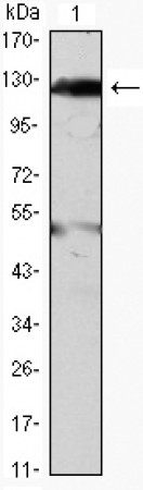 JAK2 Primary Antibody MP30041 [M1C1]