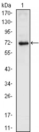 NKX2.5 Primary Antibody MP20388 [M2E1]
