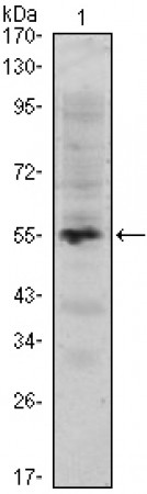 MUM1 Primary Antibody MP30048 [M4G10]