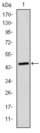 ApoB Primary Antibody MP30214 [M6G6]