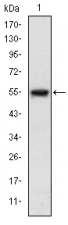MAP3K5 Primary Antibody MP30225 [M2E4]