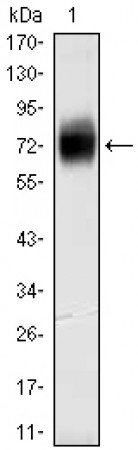 CD38 Primary Antibody MP20413 [M6E12D4A12]