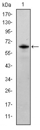 FYN Primary Antibody MP30229 [M2A10]