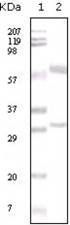 ER-alpha Primary Antibody MP20047 [M2B7]