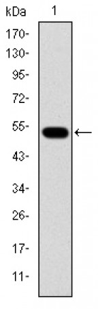 GCK Primary Antibody MP30243 [M4G6]