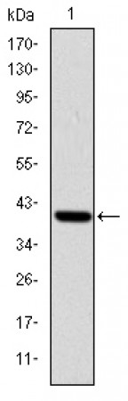 ITK Primary Antibody MP30244 [M5G6]