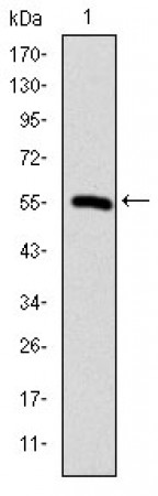 CCT2 Primary Antibody MP30274 [M5B5C4]