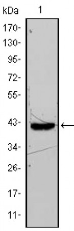 FABP4 Primary Antibody MP20409 [M9B8D]