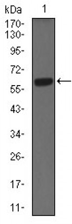 CK5 Primary Antibody MP30468A  [M10C11E6]