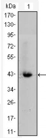 CTNNB1 Primary Antibody MP20412 [M4D5]