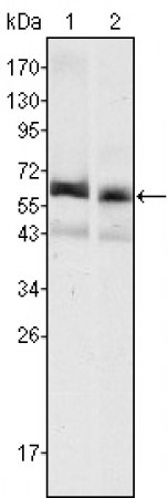 AFP Primary Antibody MP20405 [M6E6]