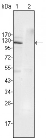 EphB4 Primary Antibody MP20221 [M7H4A6]