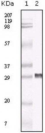 TIMP-3 Primary Antibody MP20058 [MN/A]
