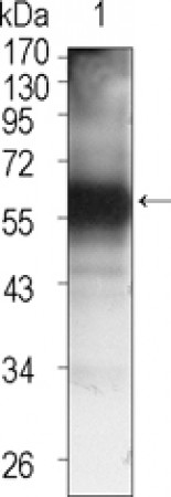TEC Primary Antibody MP20380 [M3A5]