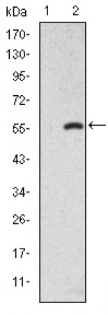 SMAD2 Primary Antibody MP30242 [M5G7]