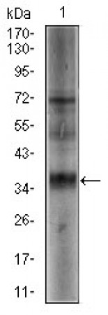 SRY Primary Antibody MP30397 [M1G4]