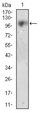 CD10 Primary Antibody MP30576 [M7D4B1]