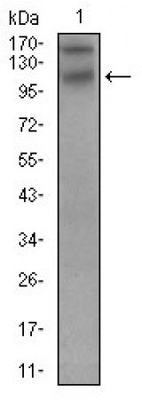DSG3 Primary Antibody MP30632 [M6G2E2]