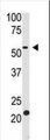 Anti-BACE2 Antibody (aa336-365) MX-C100369