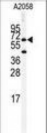 Anti-BCHE / Cholinesterase Antibody (aa385-415) MX-C97232