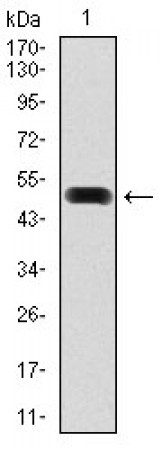 FN1 Primary Antibody MP30340 [M2F4G2]