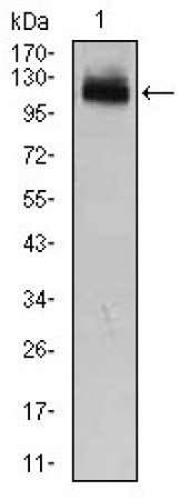 GAB1 Primary Antibody MP30358 [M1A7]