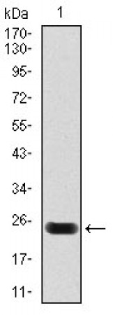troponin T2 Primary Antibody MP30361 [M1G1]