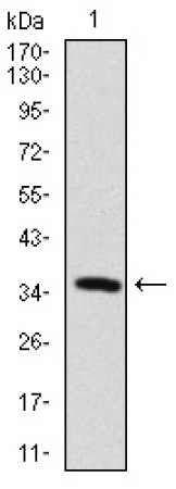 MAP2 Primary Antibody MP30377 [M5B7]