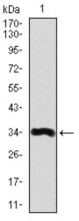 LPA Primary Antibody MP30380 [M4H1]