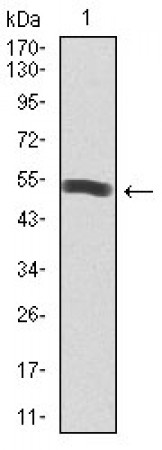 PIK3R1 Primary Antibody MP30402 [M6G10]