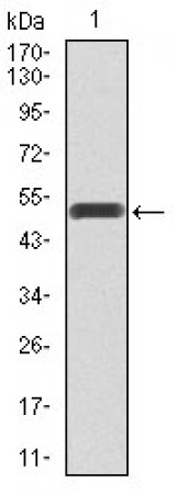 PIK3R1 Primary Antibody MP30403 [M8C11]