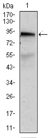 ABCB5 Primary Antibody MP30432 [M5H3C6]