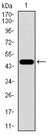 FOXC2 Primary Antibody MP30459P  [M1D11C8]