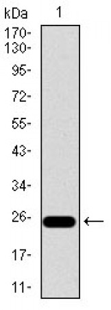 ITGB4 Primary Antibody MP30476A [M10B10D5]