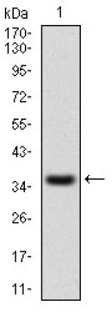 IL2RA Primary Antibody MP30522  [M1B5D12]