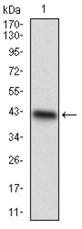 CDX1 Primary Antibody MP30537 [M1B11A9]