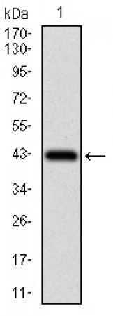ZEB1 Primary Antibody MP30547 [M2A8A6]
