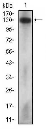 MCAM Primary Antibody MP30560 [M6C3F1]