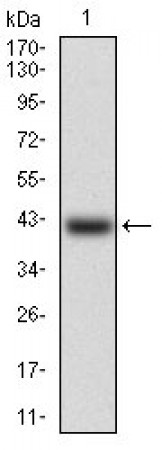RB1 Primary Antibody MP30584 [M2A11D11]