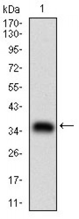 ABCB1 Primary Antibody MP30593 [M6G11F8]