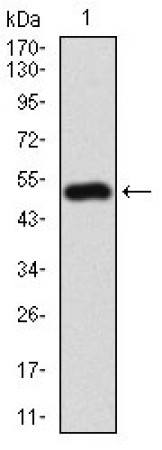 APBB1IP Primary Antibody MP30720 [M7E7A3]