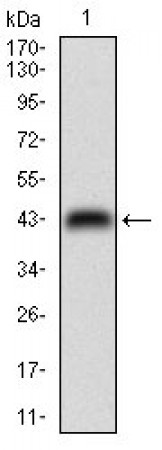 NME2 Primary Antibody MP30736 [M4G7A8]