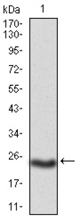 PKHD1 Primary Antibody MP30740 [M8G12A1]