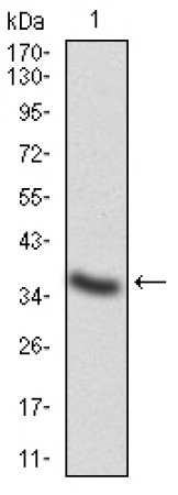CTSD Primary Antibody MP30778 [M2H4H5]